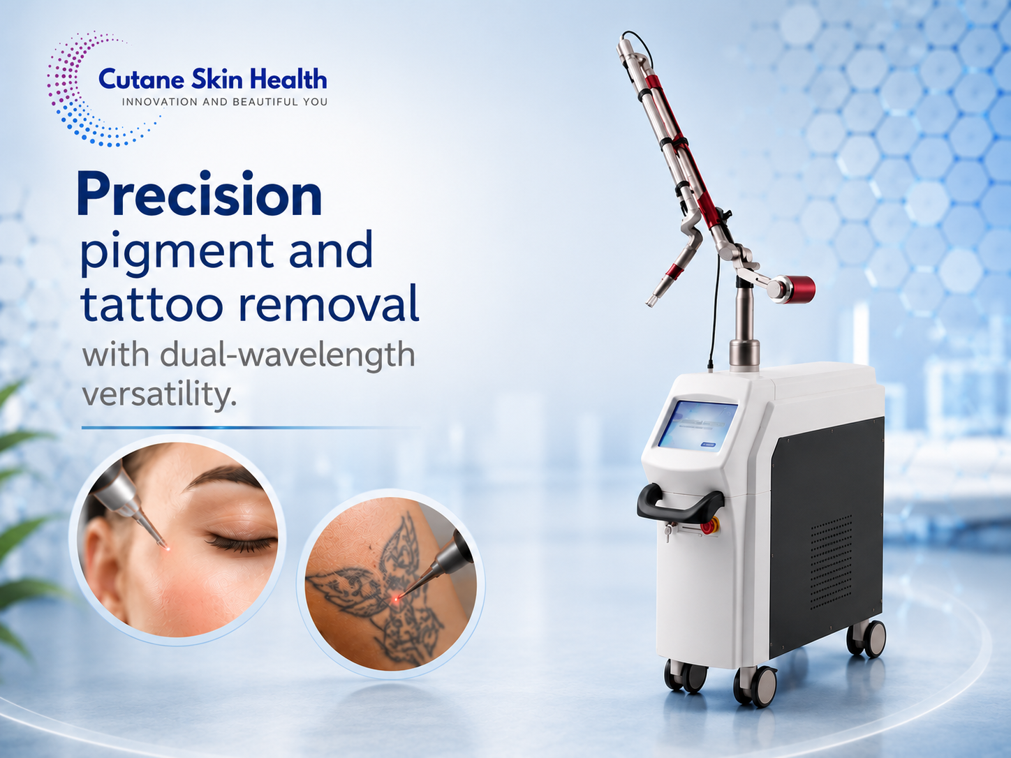 1064 Q-switch Nd:YAG laser aesthetic device in clinic setting